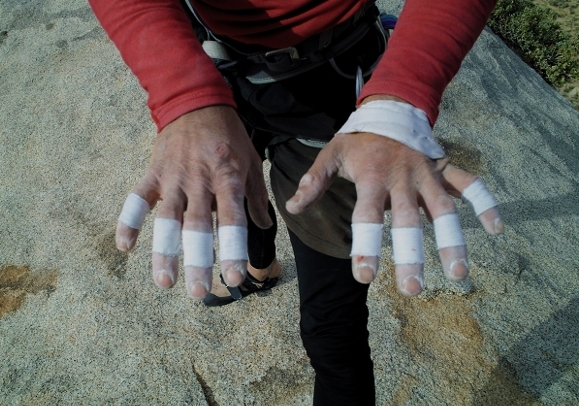 Photo: Joshua Tree trashed hands at the top of 'Equinox' 5.12c